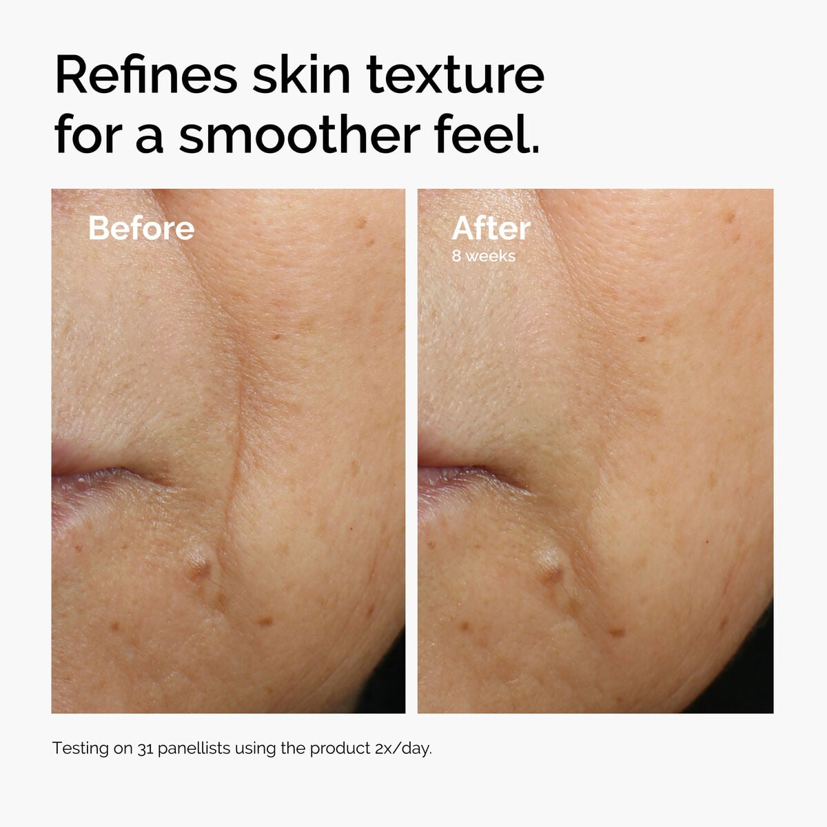 Caffeine + Escin Face Serum Targeted Serum Care S3