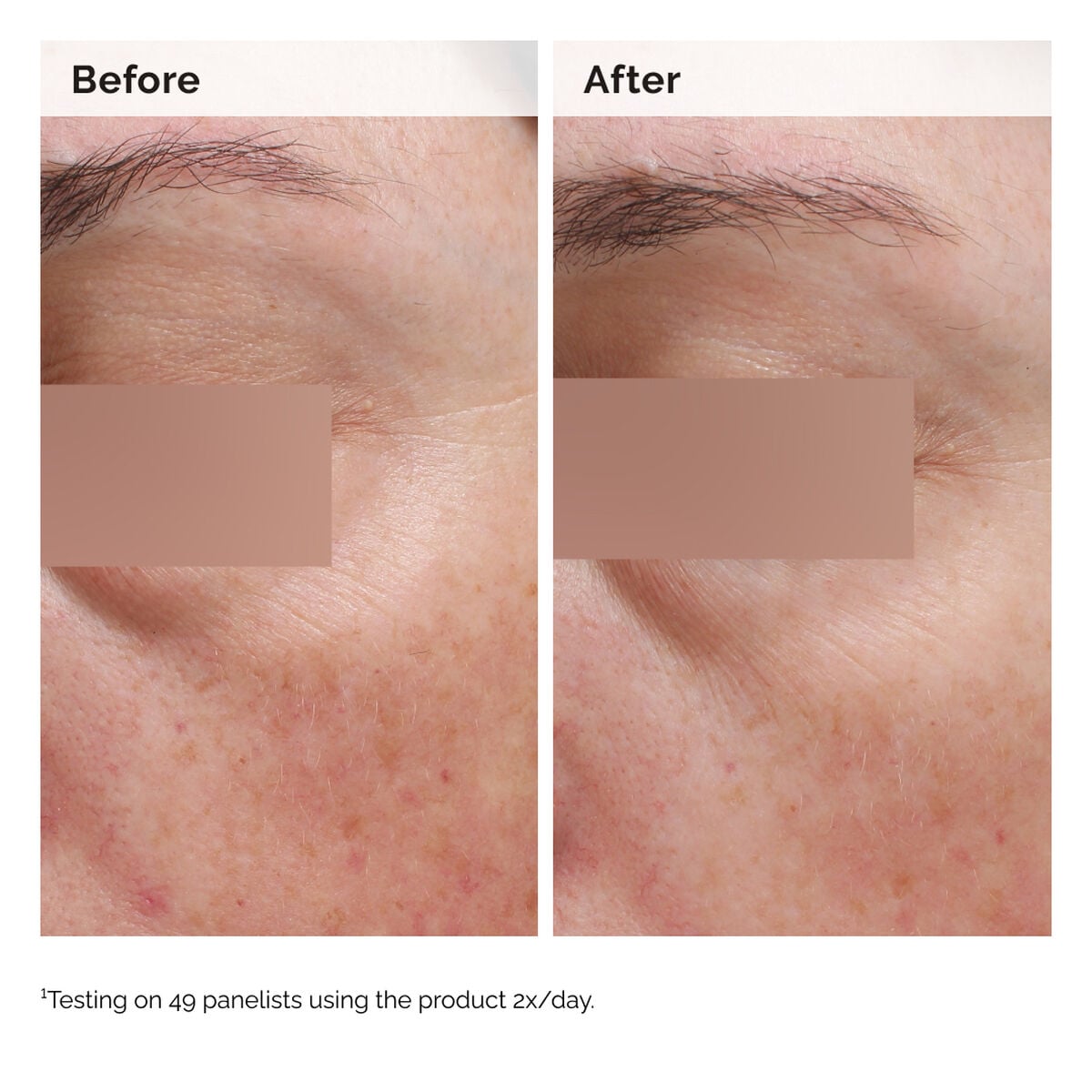 Niacinamide Face and Body Emulsion Targeted Serum Care E1
