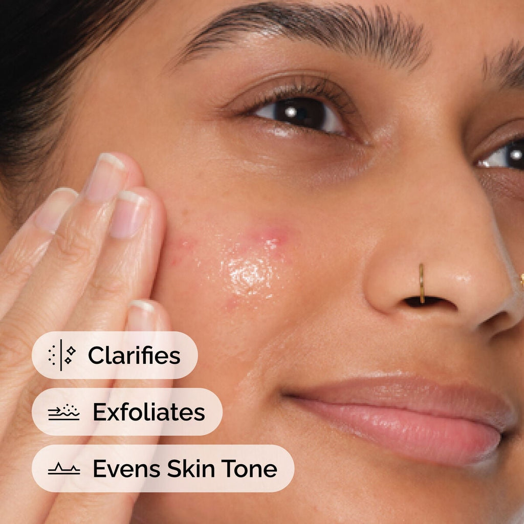 Salicylic Acid Anhydrous Solution Targeted Serum Care A0