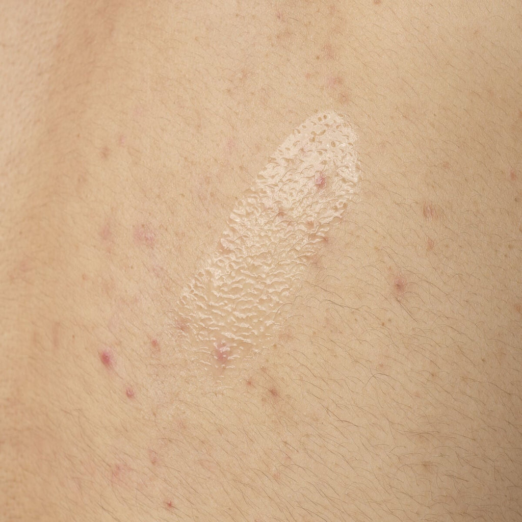 Salicylic Acid Body Serum Targeted Serum Care Z8
