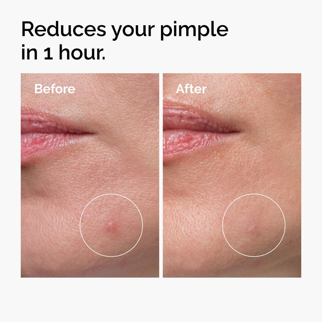 Sulfur Powder-to-Cream Concentrate Daily Treatment Ritual Q4